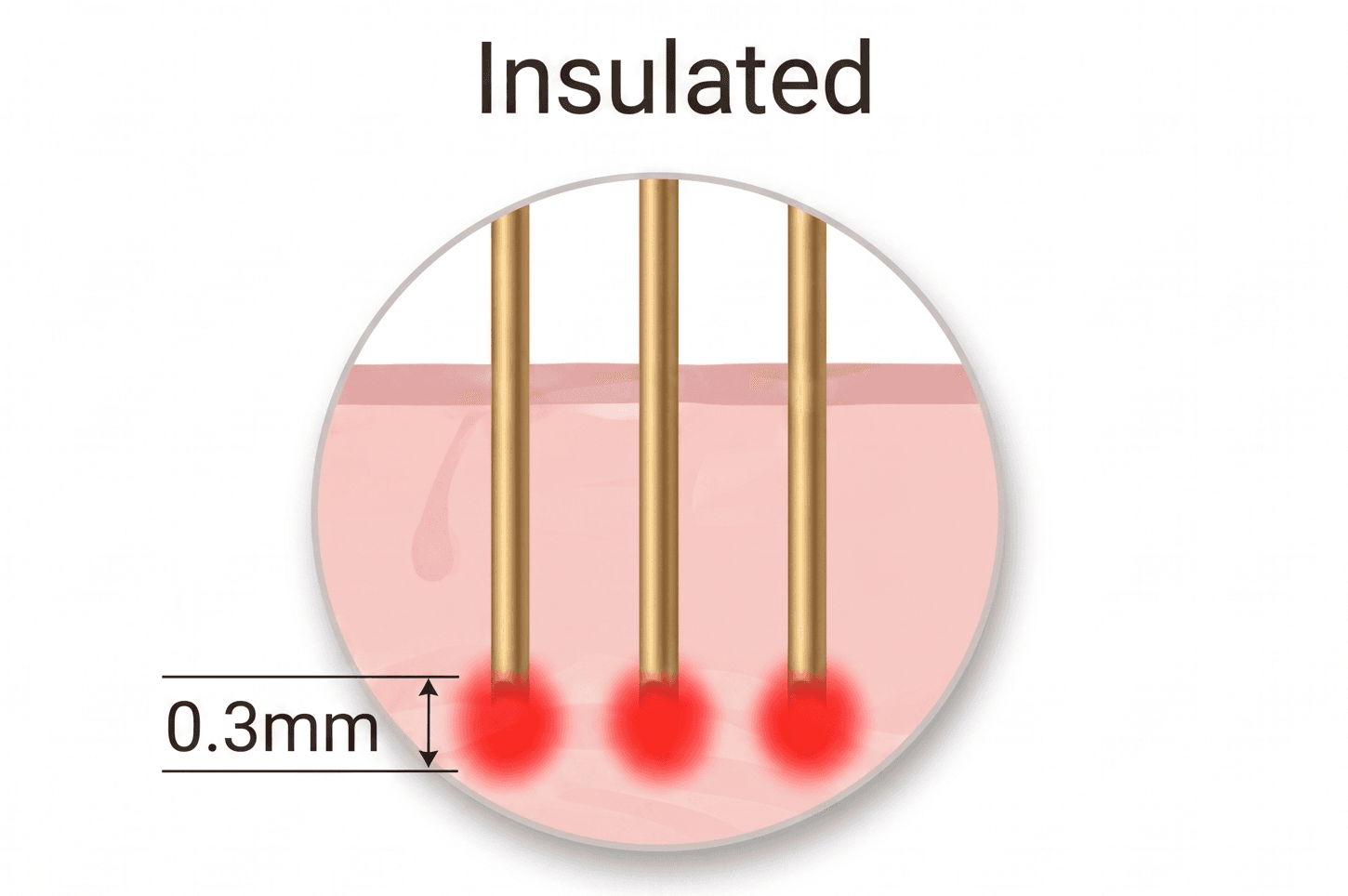 insulated Tips